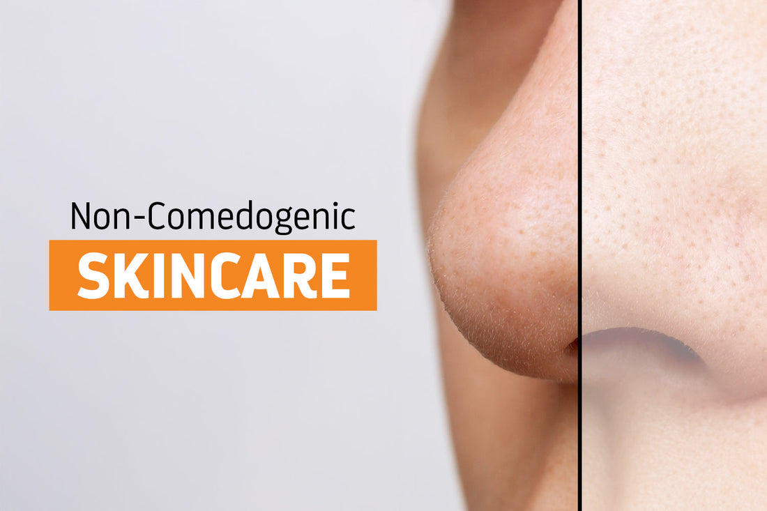 What is Non-Comedogenic Skincare?