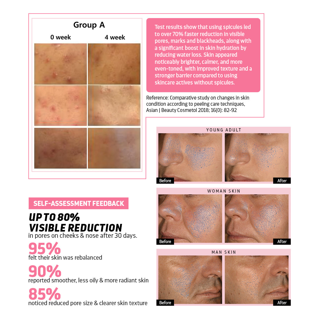 Encapsulated Cica Reedle Essence with 4th Gen Spicule & Ginseng PDRN - 30mL