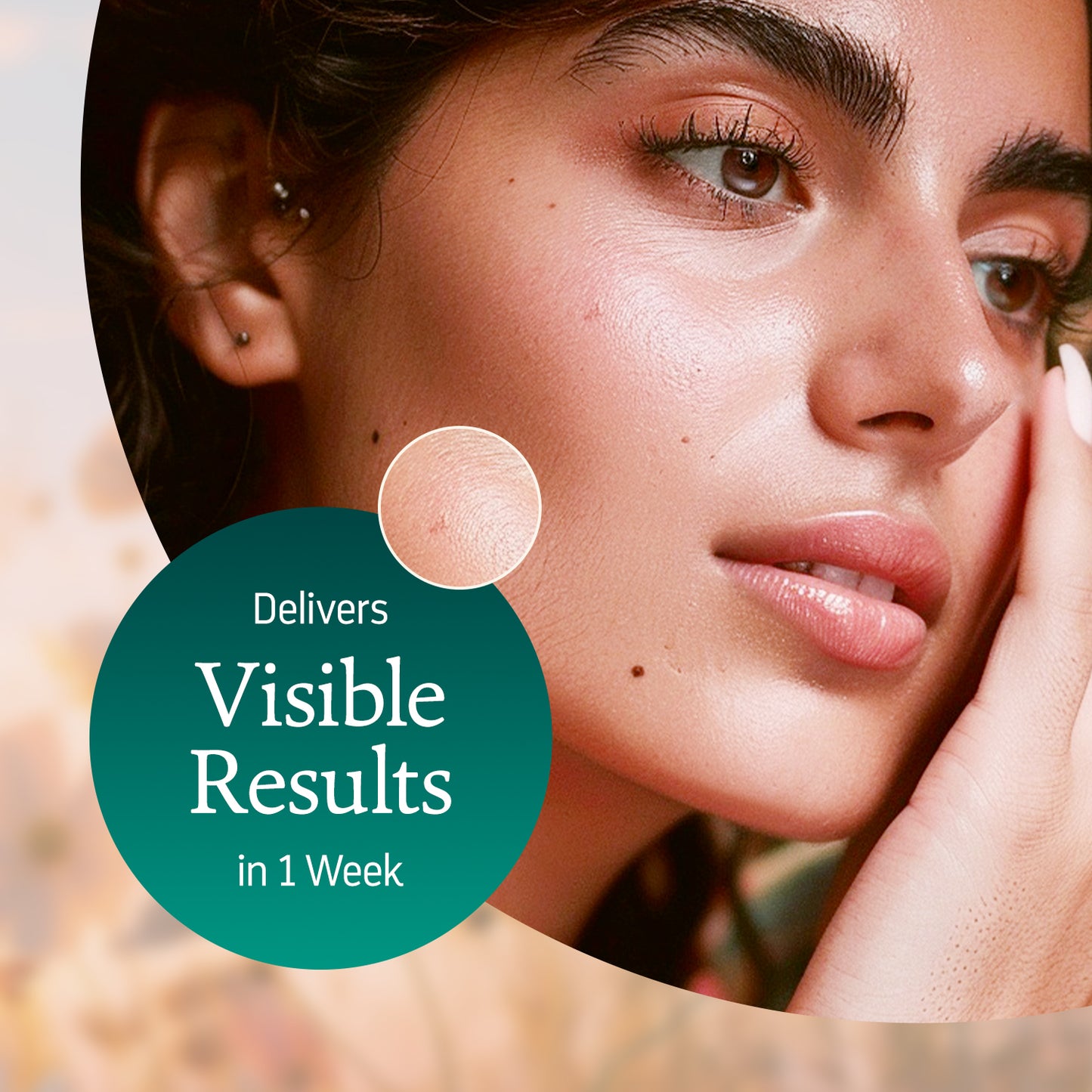 Heads Off - Anti Acne Serum For Blackheads & Whiteheads