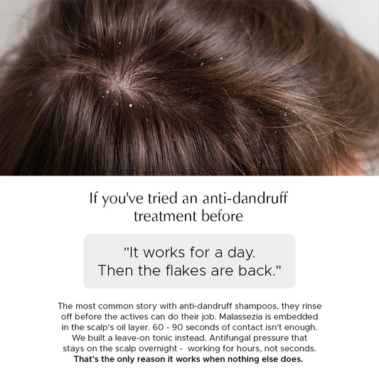 Anti Dandruff Scalp Tonic For Reduced Irritation & Scalp Health