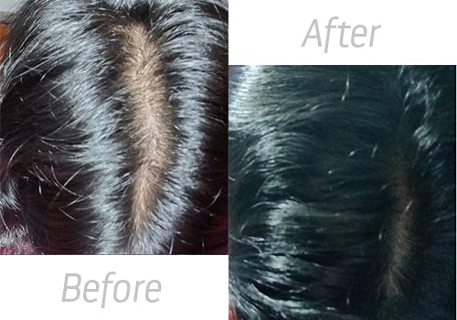 Hair Vitalizer serum