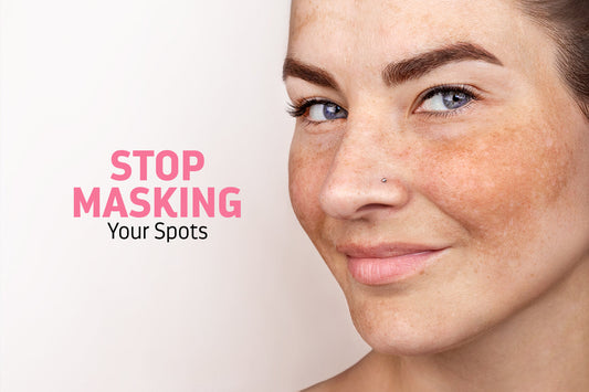 What Is Hyperpigmentation? A Guide to Your Dark Spots