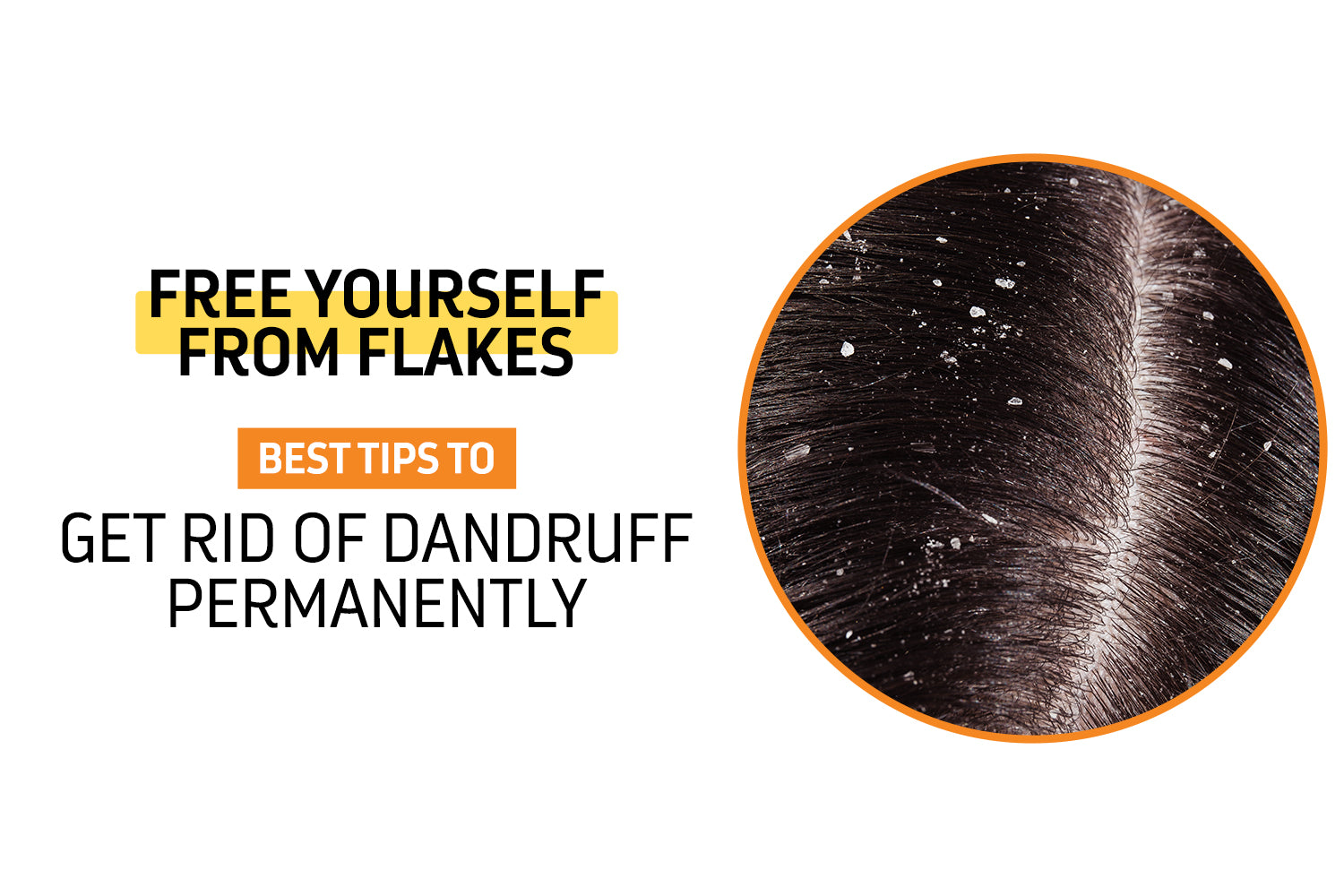Get Rid of Dandruff Permanently: Effective Solutions for Flake-Free ...