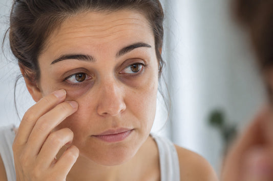 Puffy Eyes, Dark Circles, Fine Lines: Are You Using the Wrong Eye Product for Your Actual Problem?