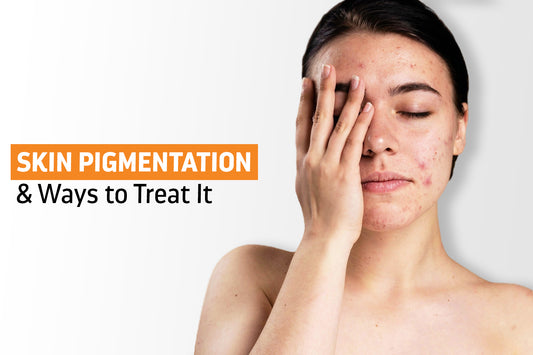 Skin Pigmentation and Ways to Treat It