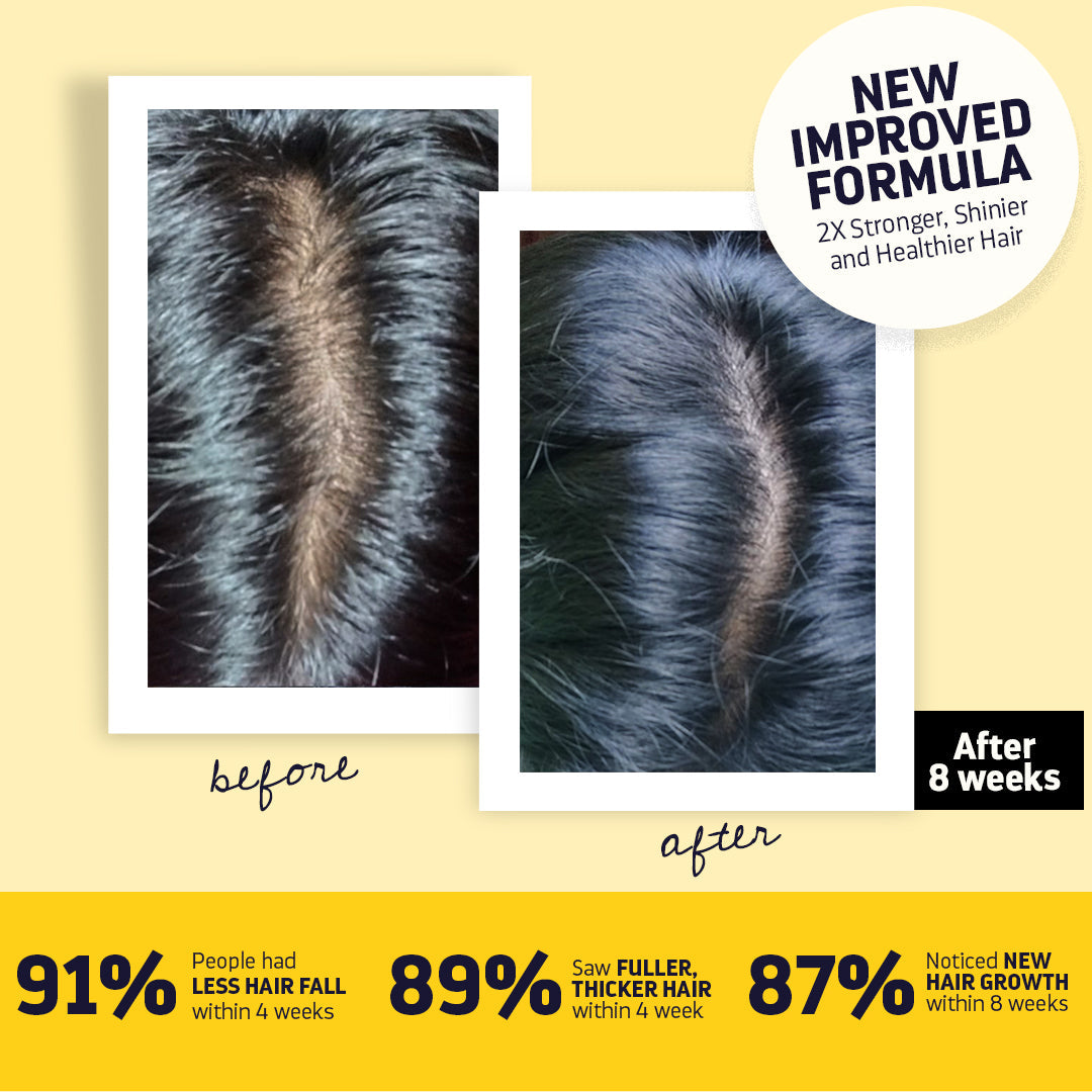 BYOB- Luxuriant Hair Vitalizer 2.0 | Anti Hairfall Non Oily Hair Growth Serum