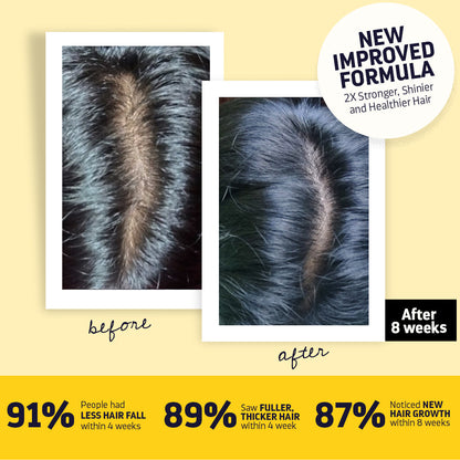 BYOB- Luxuriant Hair Vitalizer 2.0 | Anti Hairfall Non Oily Hair Growth Serum