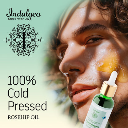 Rosehip Oil - 100% Cold Pressed Oil for Repair & Brightening (30ml)