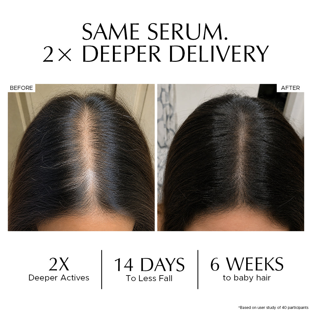 Combo: Encapsulated Cica Reedle Essence + Hair Vitalizer 2.0