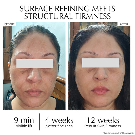 COMBO : Vitamin A Pro Retinol Restoring Essence + Pep Tite - Skin Firming Moisturizer