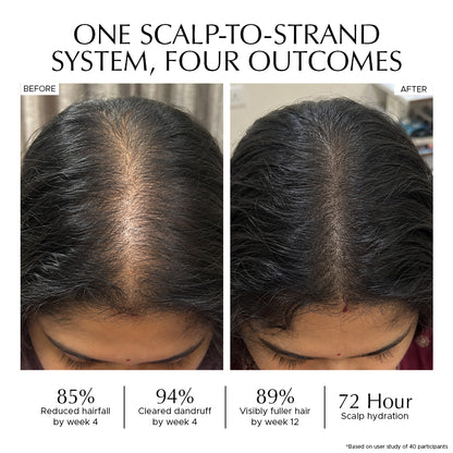Haircare Combo: Anti-Dandruff Scalp Tonic + Hair Vitalizer 2.0 + Rosemary & Rice Water Mist