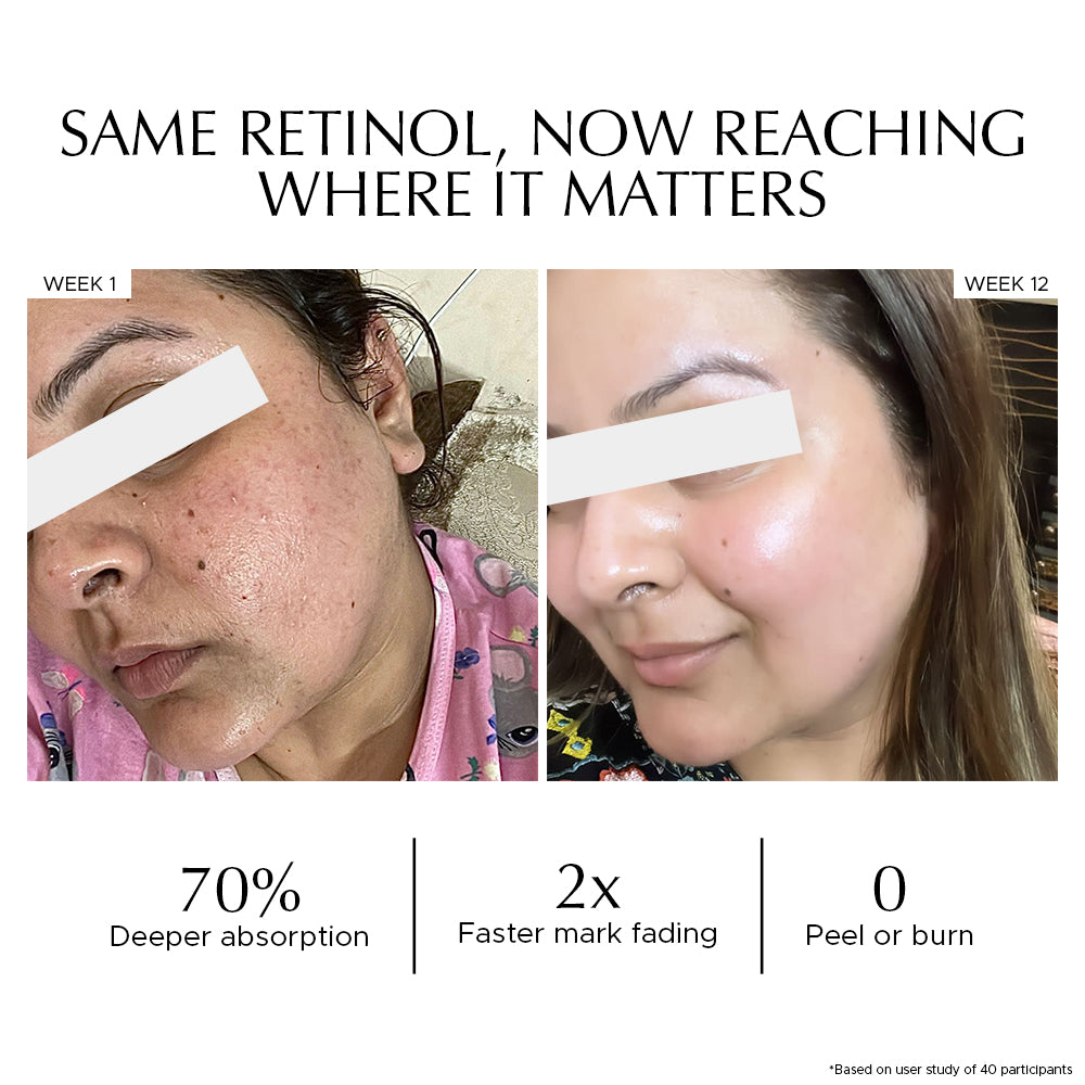 Combo: Encapsulted Cica Reedle Essence + Vitamin A Pro Retinol