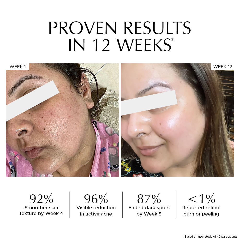 Vitamin A Pro-Retinol Night Cream For Anti Aging & Skin Renewal