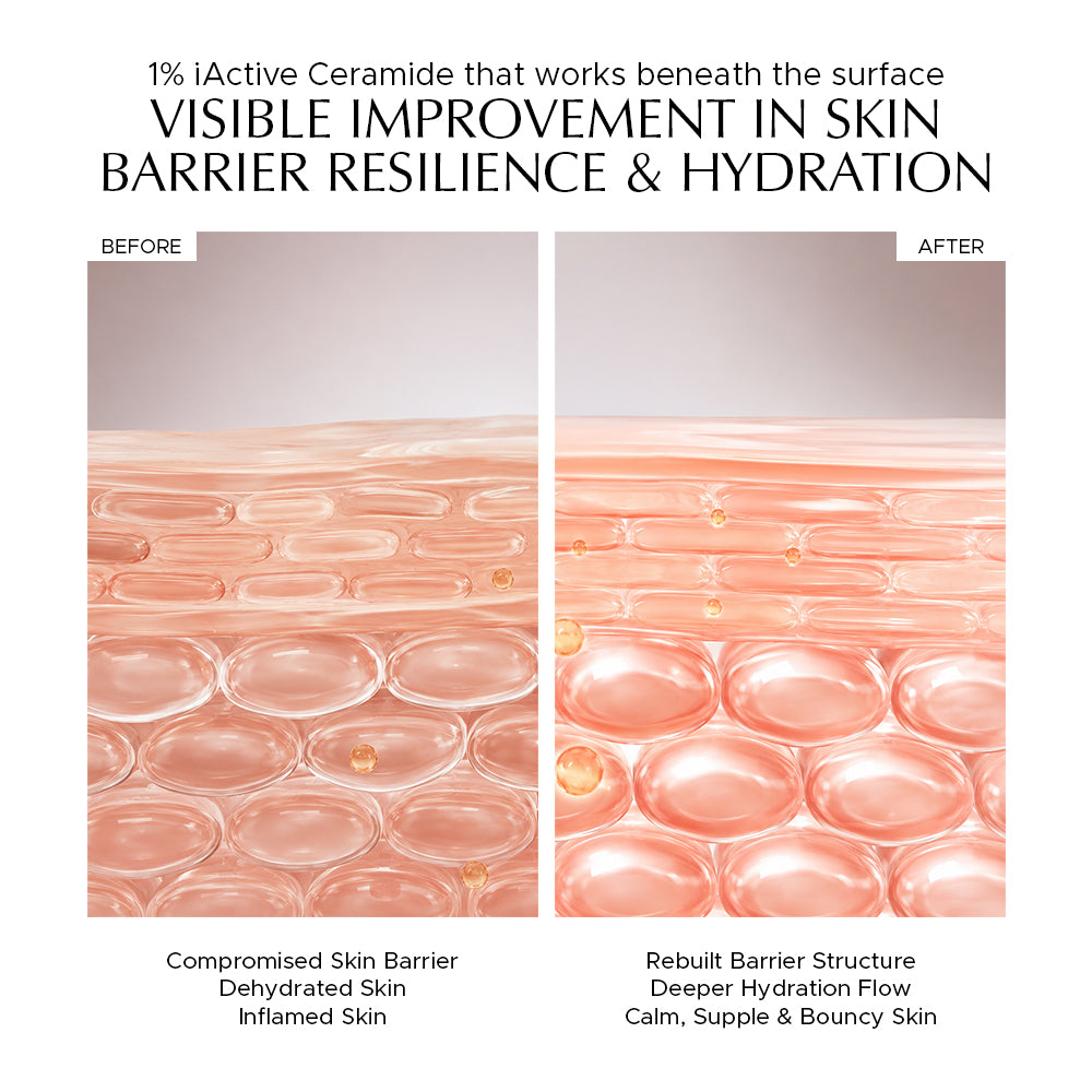 CERA MOIST - 1% iActive Ceramide Calming Moisturizer for Hydration & Skin Barrier Repair