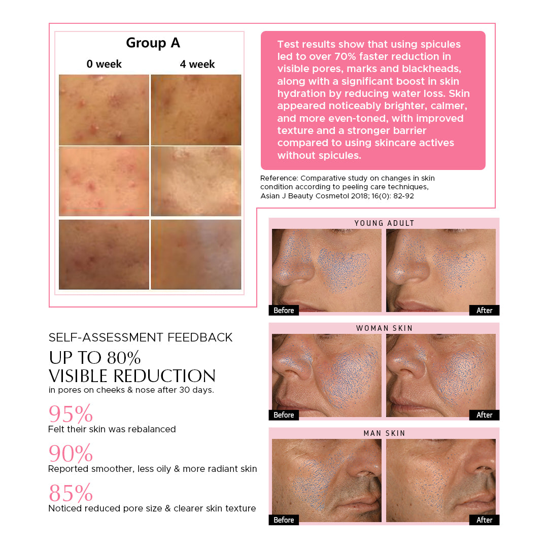 Encapsulated Cica Reedle Essence with 4th Gen Spicule & Ginseng PDRN - 30mL