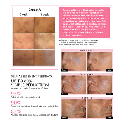 Encapsulated Cica Reedle Essence with 4th Gen Spicule & Ginseng PDRN - 30mL