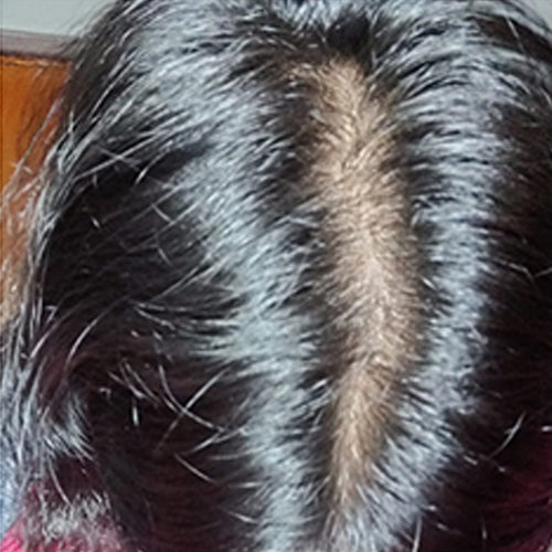 Luxuriant Hair Vitalizer 2.0 | Non Oily Serum For Hairfall