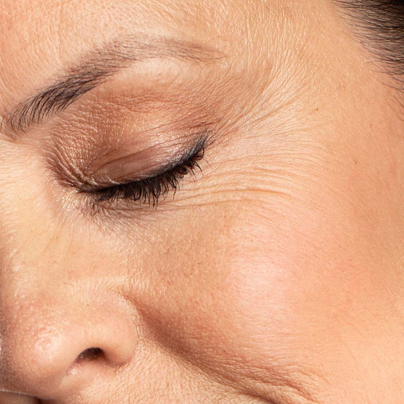 Fine Lines & Wrinkles