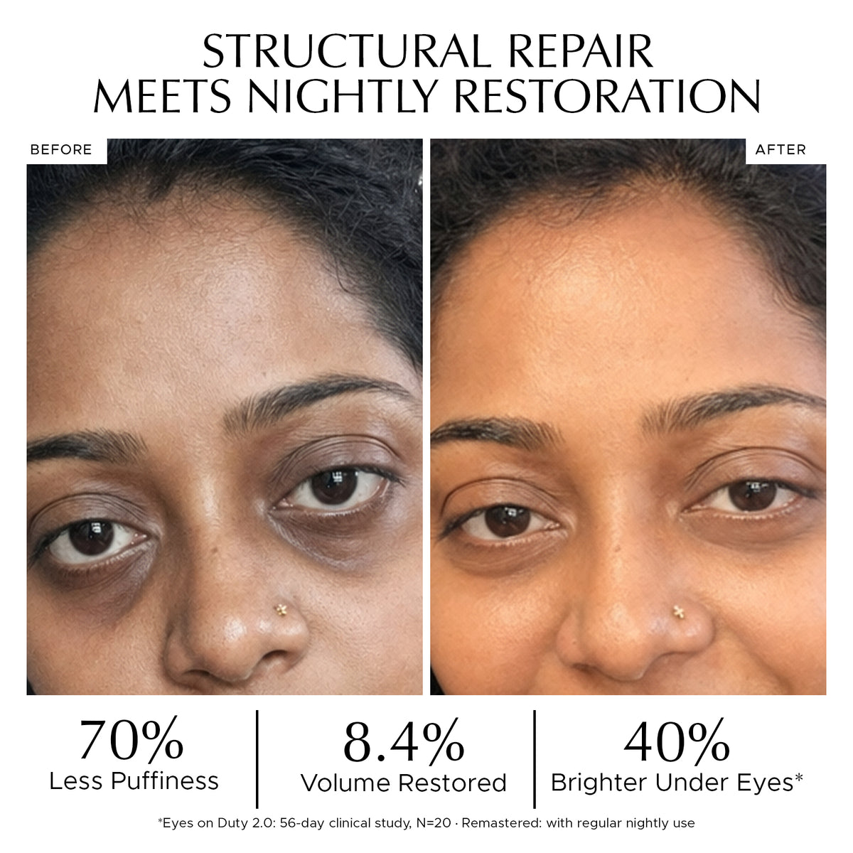 COMBO : Eyes on Duty 2.0 + Remastered Rejuvenating Eye Serum - AM/PM Eye Ritual