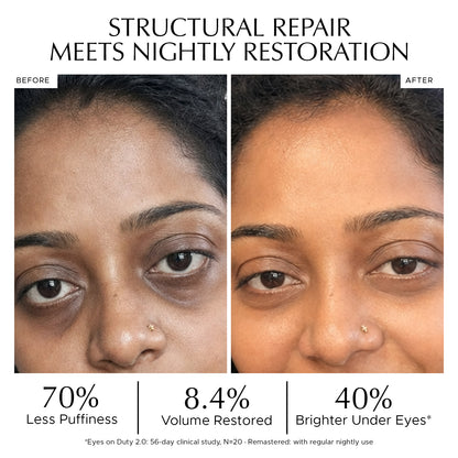 COMBO : Eyes on Duty 2.0 + Remastered Rejuvenating Eye Serum - AM/PM Eye Ritual