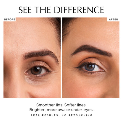 Before and after close-up of a woman's eye showing smoother lids and softer lines with brighter under-eyes