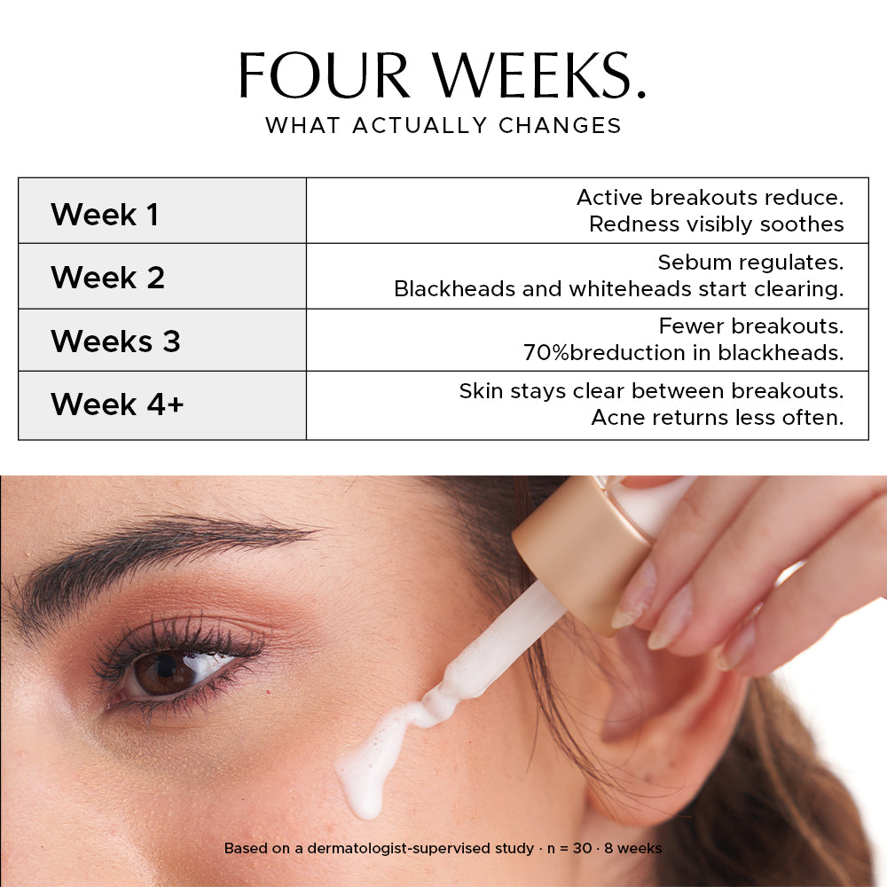 Heads Off - Anti Acne Serum For Blackheads & Whiteheads
