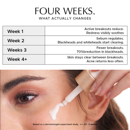 Heads Off - Anti Acne Serum For Blackheads & Whiteheads