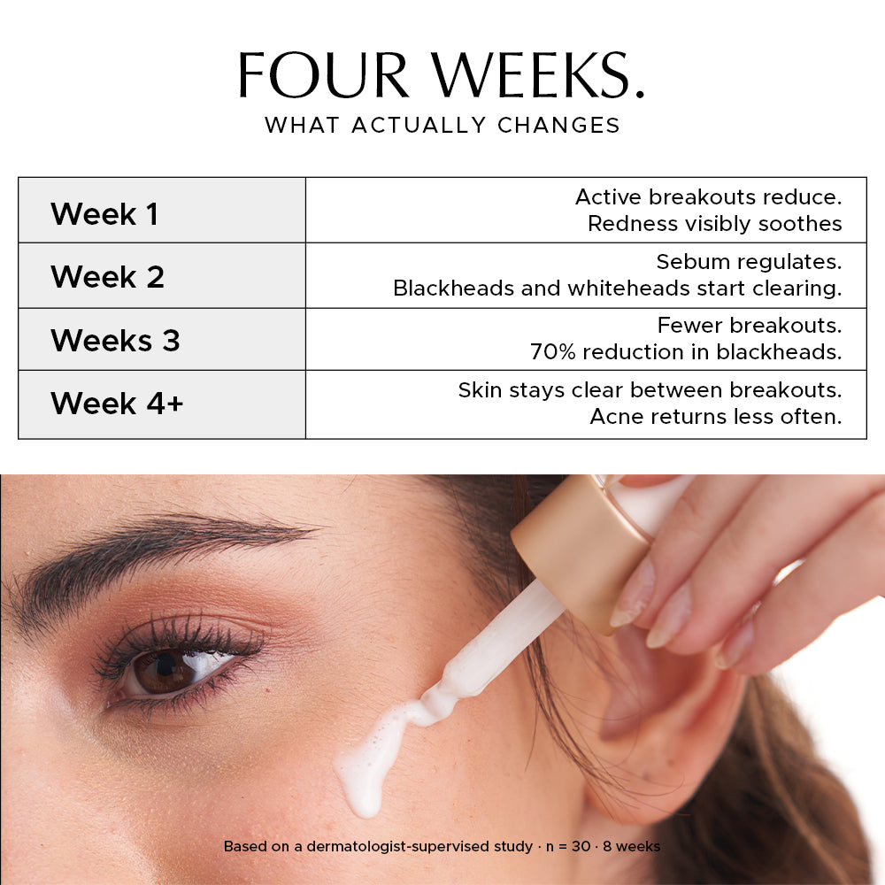 Four-week acne treatment timeline with weekly skin improvement details and a close-up of serum being applied near the eye