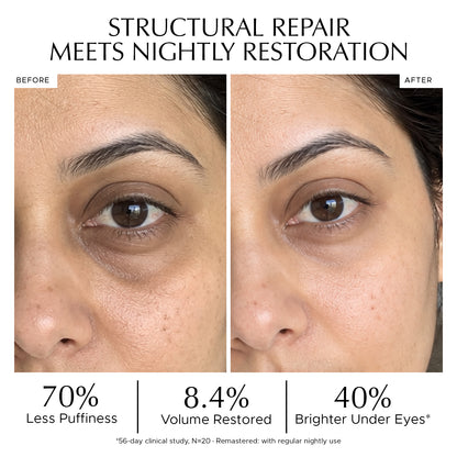 Before and after close-up photos of a woman's eye showing reduced puffiness and brighter under eyes with clinical study results. STRUCTURAL REPAIR MEETS NIGHTLY RESTORATION. 70% Less Puffiness, 8.4% Volume Restored, 40% Brighter Under Eyes. best under eye serum for dark circles India, Indulgeo Essentials before and after under eye results, eye gel for puffy eyes clinical study, dark circles reduction before after, volume restoring under eye serum, dark circles aur eye bags kam karne ka gel result, Indulgeo 