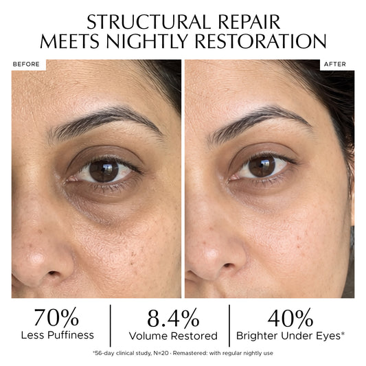 Before and after close-up photos of a woman's eye showing reduced puffiness and brighter under eyes with clinical study results. STRUCTURAL REPAIR MEETS NIGHTLY RESTORATION. 70% Less Puffiness, 8.4% Volume Restored, 40% Brighter Under Eyes. best under eye serum for dark circles India, Indulgeo Essentials before and after under eye results, eye gel for puffy eyes clinical study, dark circles reduction before after, volume restoring under eye serum, dark circles aur eye bags kam karne ka gel result, Indulgeo 