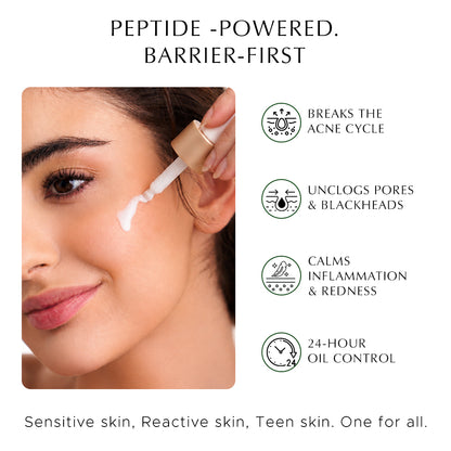 Heads Off - Anti Acne Serum For Blackheads & Whiteheads