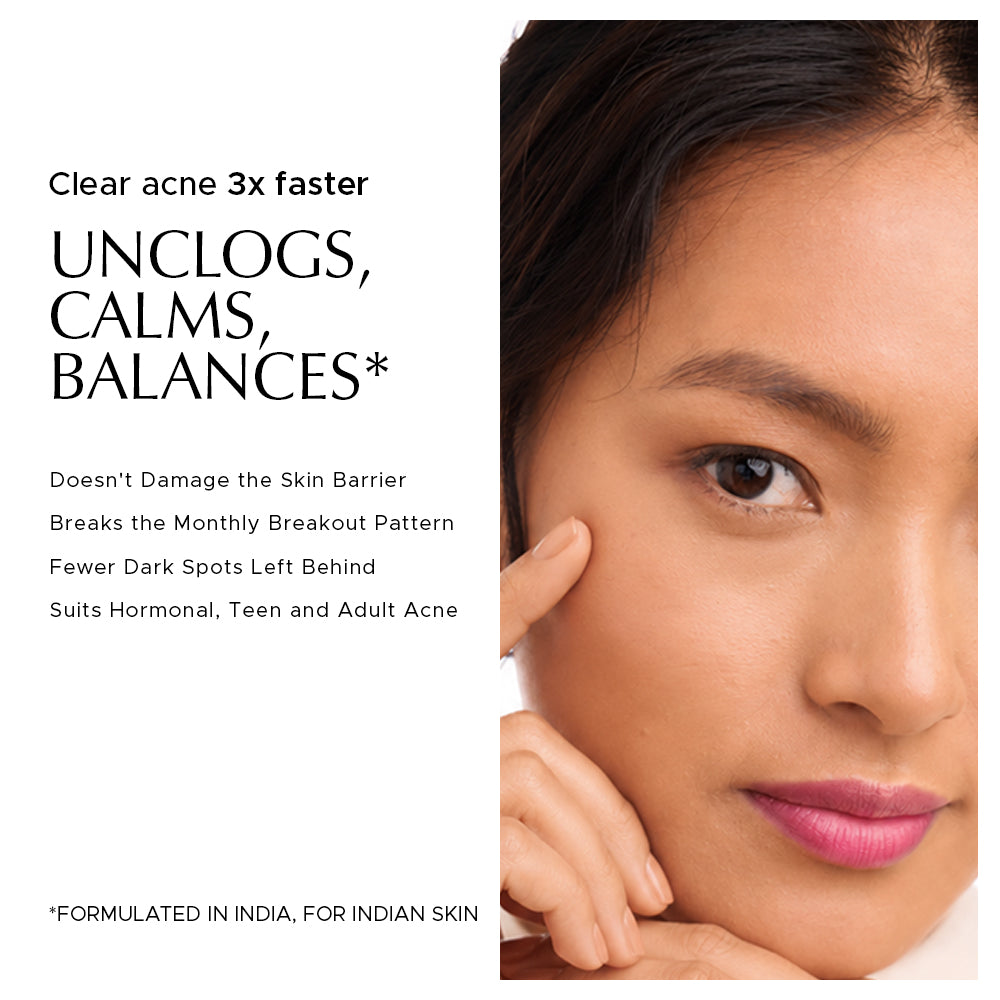Heads Off - Anti Acne Serum For Blackheads & Whiteheads