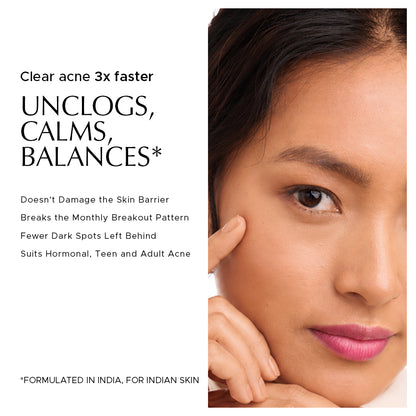 Heads Off - Anti Acne Serum For Blackheads & Whiteheads