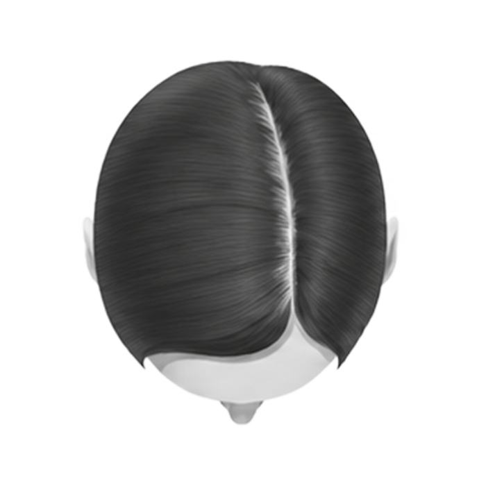 Stage 1 — healthy density