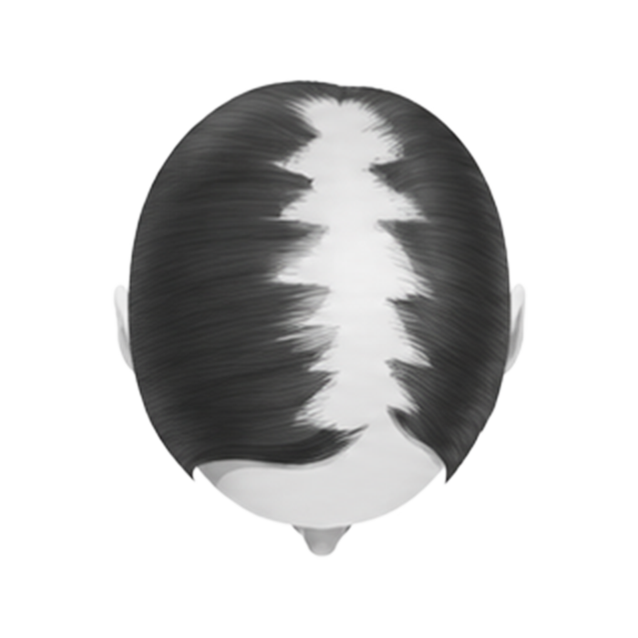 Stage 4 — see-through crown