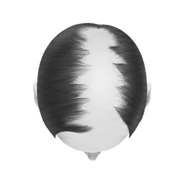 Stage 5 — sparse coverage